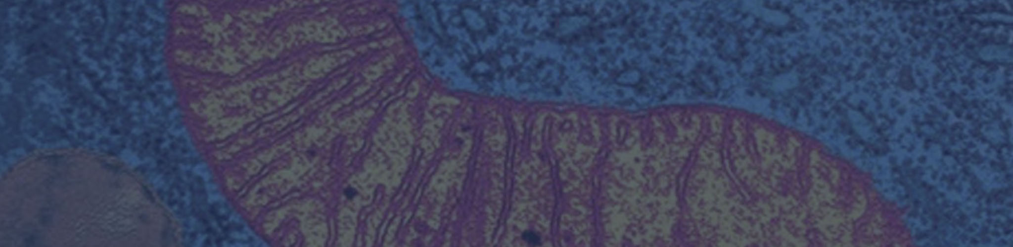 mitochondria-blue-overlay Microscopic photograph of mitochondria with blue overlay.