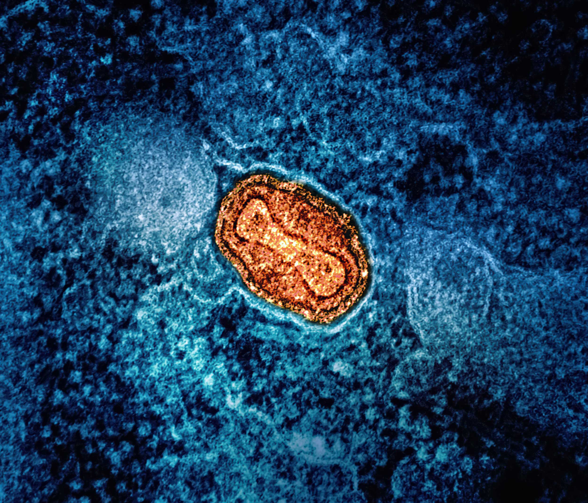 Microscope view of the mpox virus (colourized red-orange) on a dark blue background